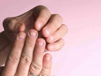 Witte vlekjes op je nagels (leukonychia), wat kun je er (zelf) tegen doen?