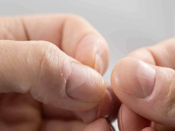 Wat zijn geribbelde nagels en wat kun je er (zelf) tegen doen?