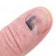 Blauwe nagel? Bloeduitstorting verhelpen & lakken