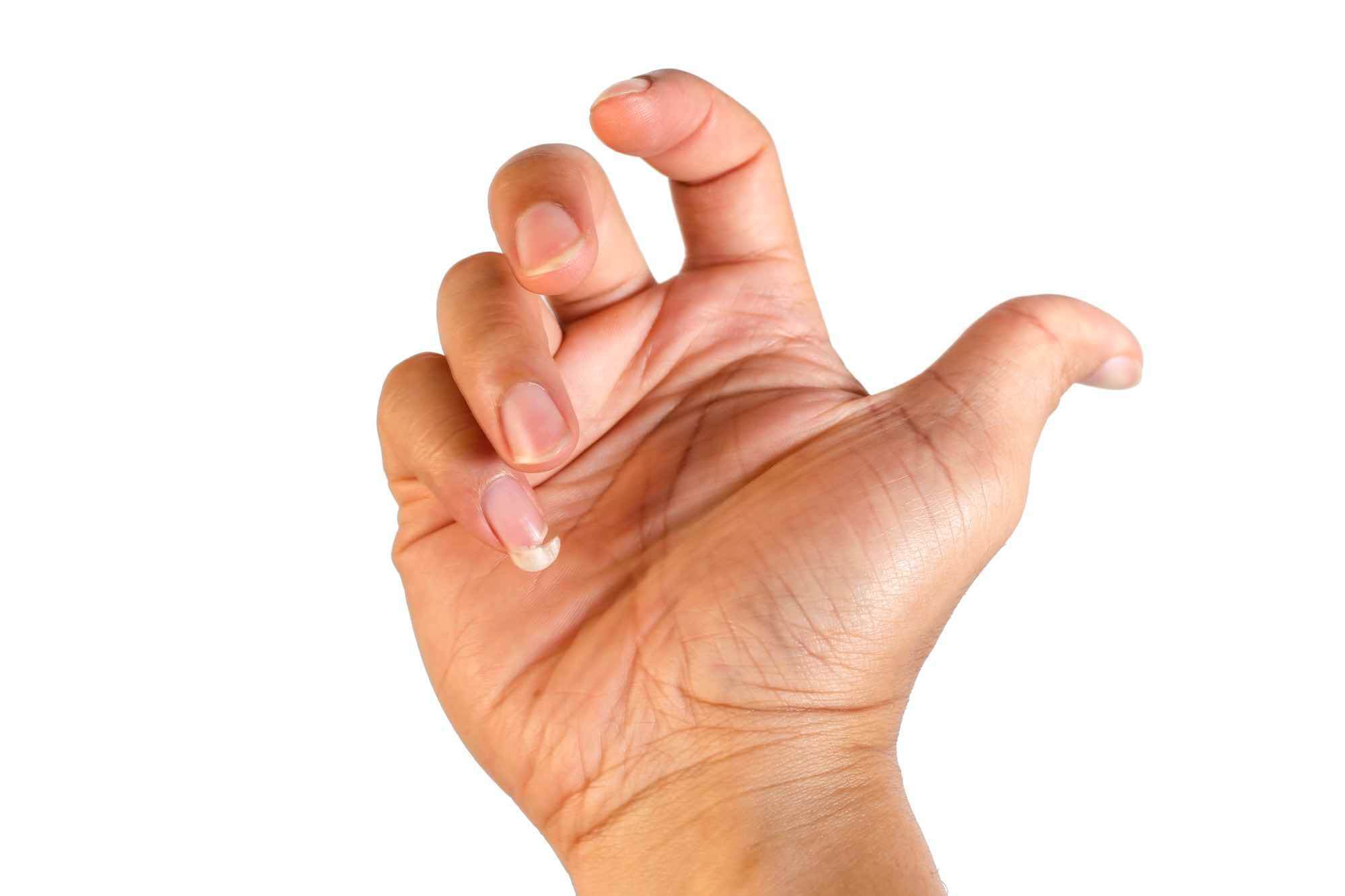 gescheurde nagel pink