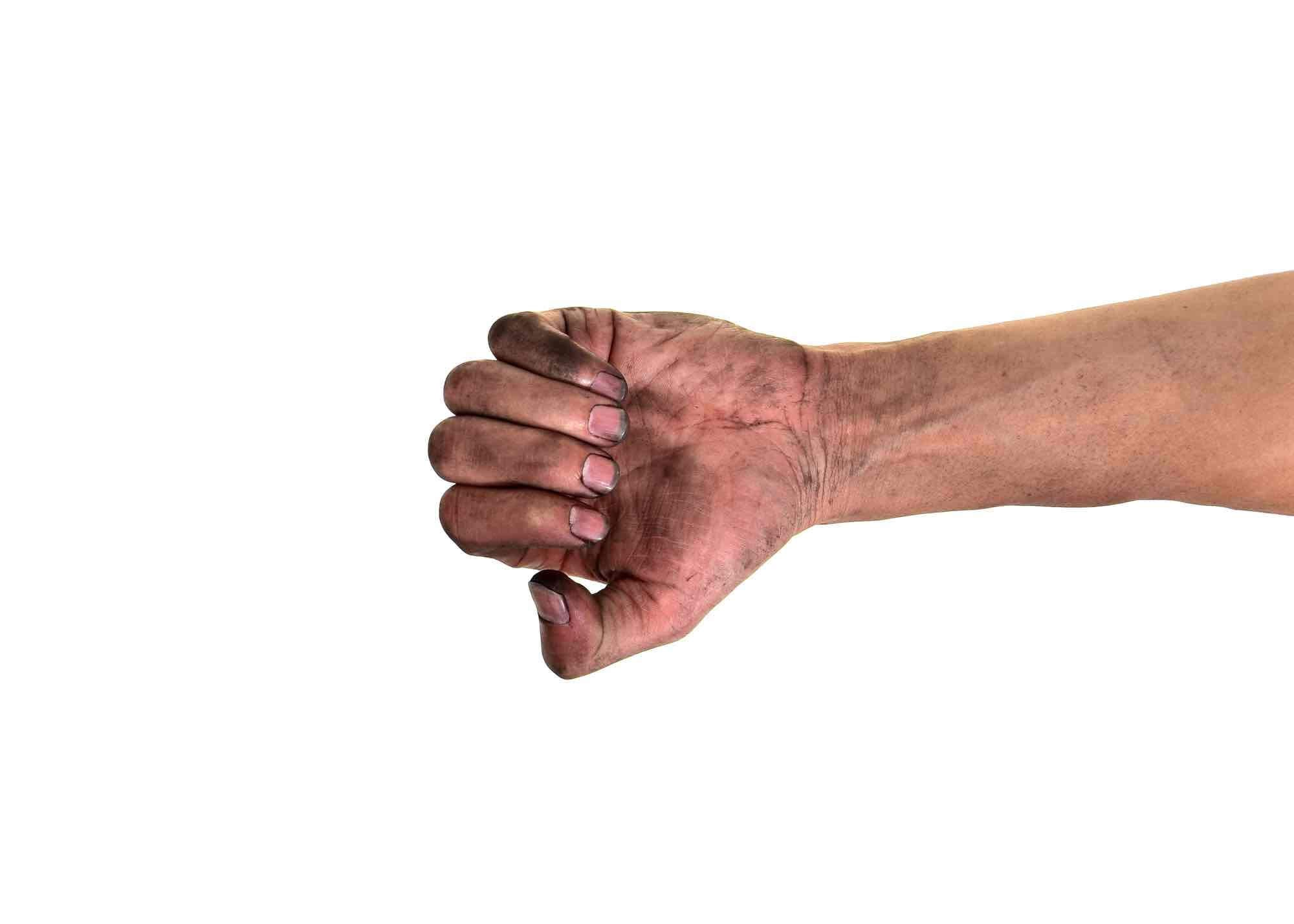 vieze vingernagels en handen